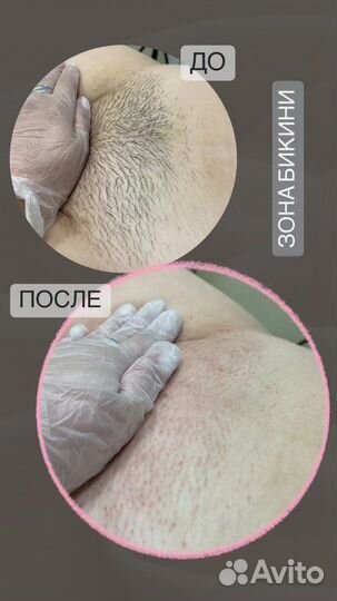 Гелинг