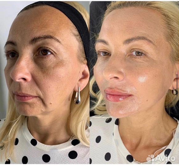 Красота и омоложение