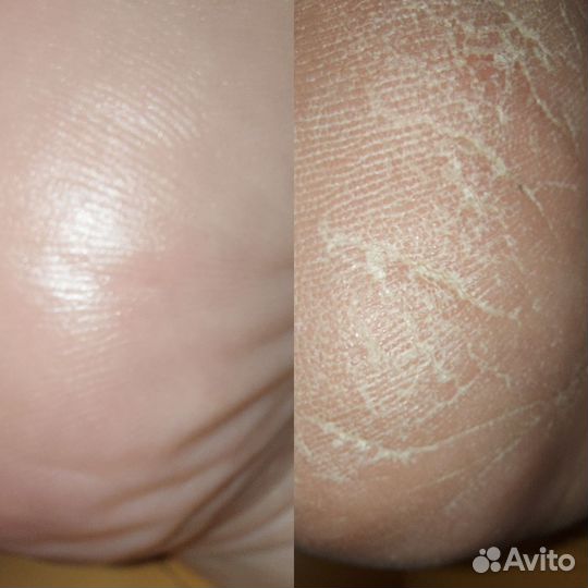 Модели на SMART педикюр