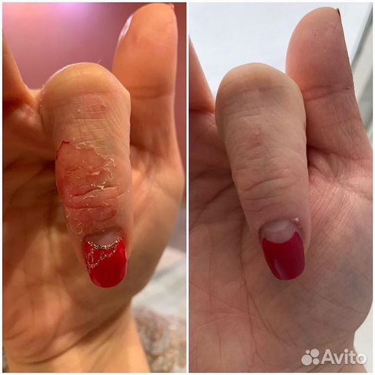 Восстанавливающий крем (псориаз,дерматит и тд)