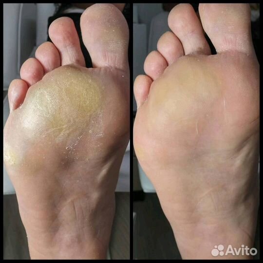 Маникюр, педикюр +гель-лак