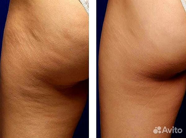 Массаж в Кемерово, все виды