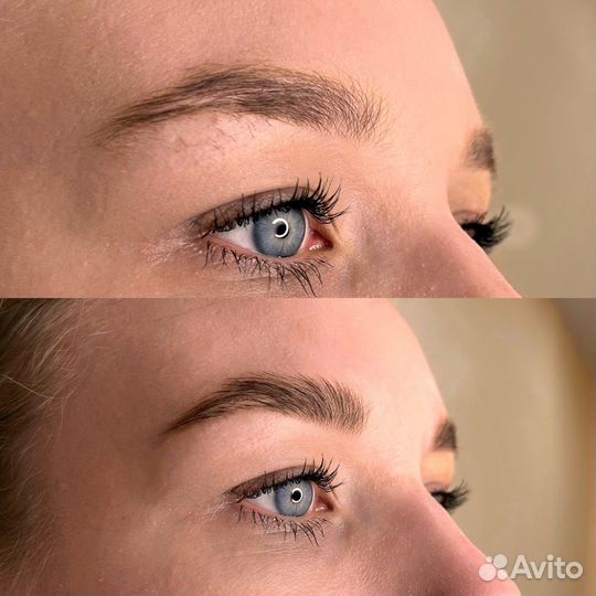 Консультация косметолога