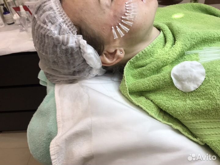 Обучение инъекционной косметологии