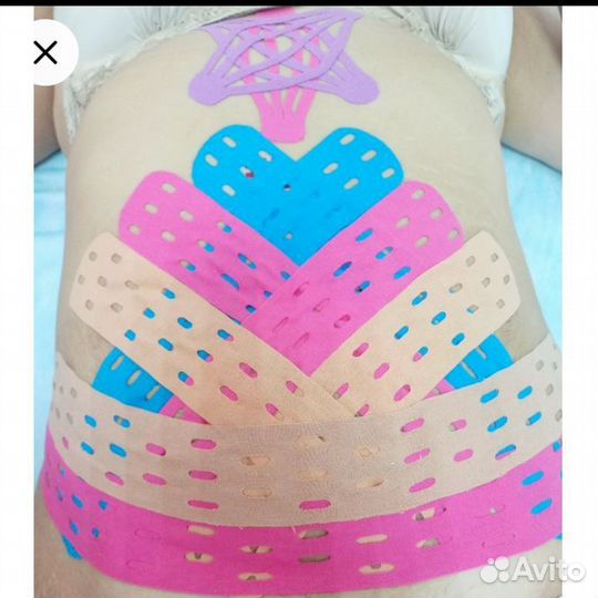 Тейпирование живота обучение