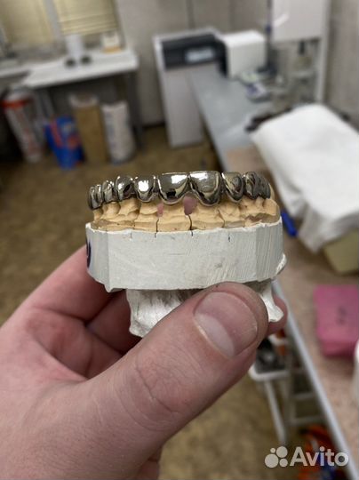 Зуботехническое литьё. Зубной техник литейщик