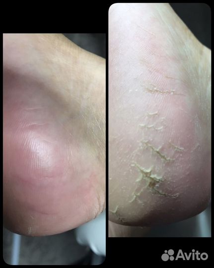 Маникюр педикюр