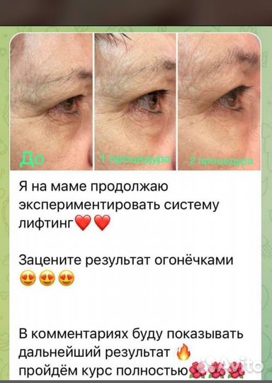Лифтинг- программа для ухода за кожей лица и шеи