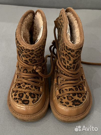 Уги на девочку