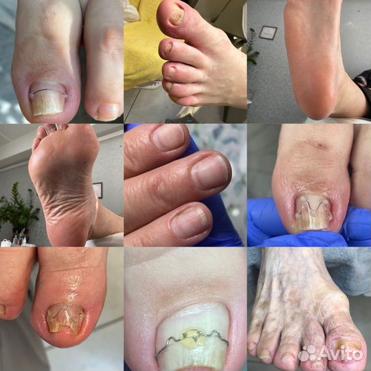 Педикюр, Подолог