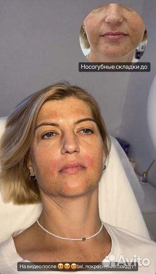 Услуги косметолога