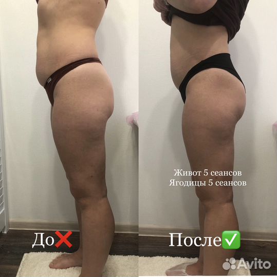 Коррекция фигуры и лифтинг лица