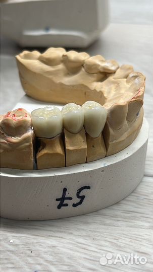 Зубной техник керамист