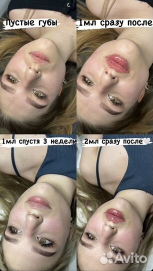 Услуги косметолога