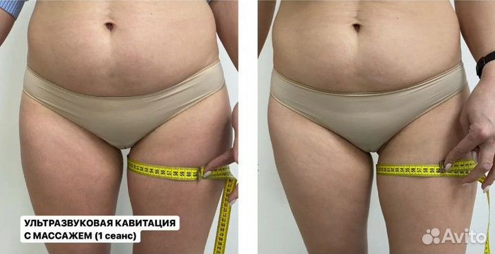 Услуги кавитации/Кавитация