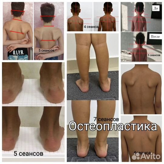 Детский массаж физио (электрофарез, смт ) на дому