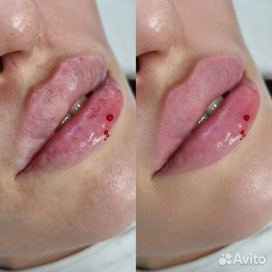 Ретушь фото