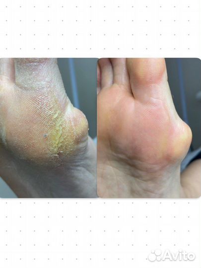 Аппаратный маникюр