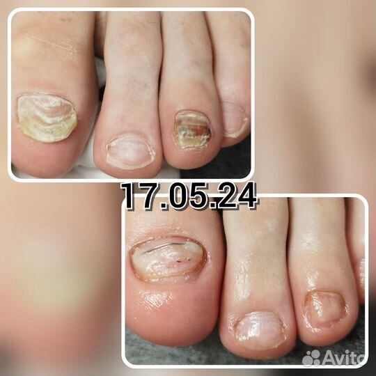 Педикюр-подолог, маникюр, депиляция, брови