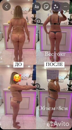 Коррекция фигуры