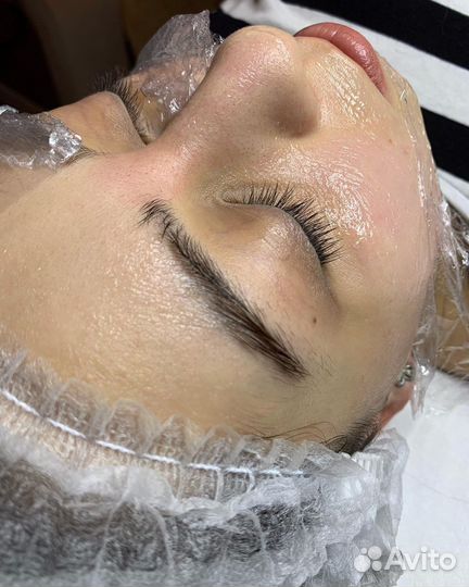 Механическая чистка лица