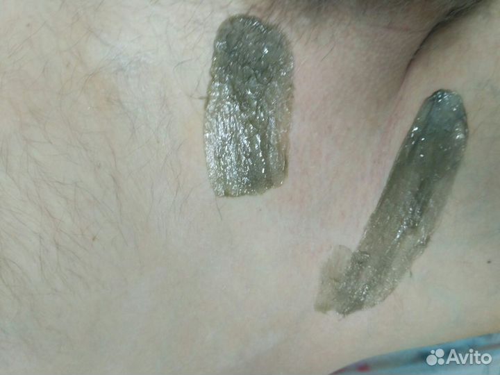 Мужская депиляция,эпиляция для мужчин