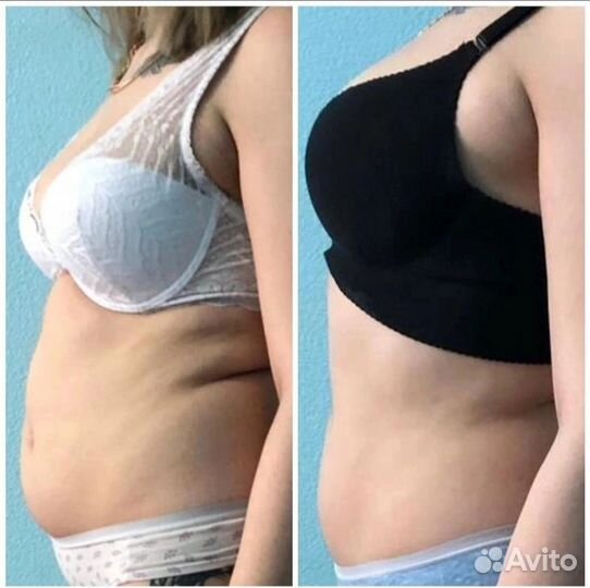 Вакуумный массаж + 4 процедуры для похудения