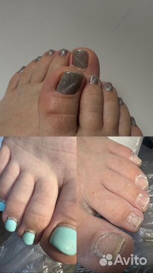 Смарт педикюр