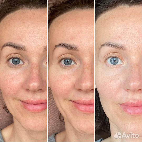 Омолаживающий массаж лица