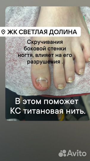 Лечебный педикюр