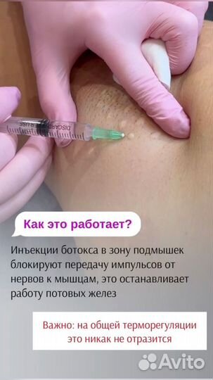 Лечение гипергидроза