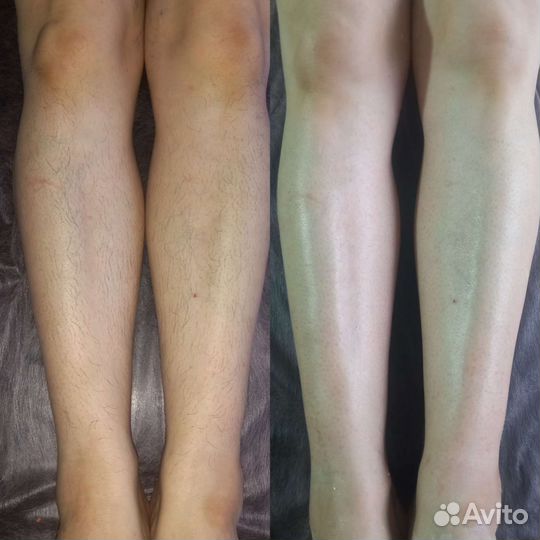 Модели на шугаринг