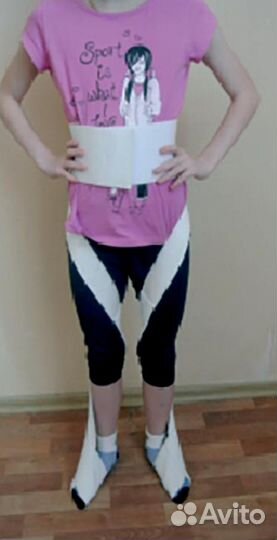 Деротационная манжета(динамический бандаж)