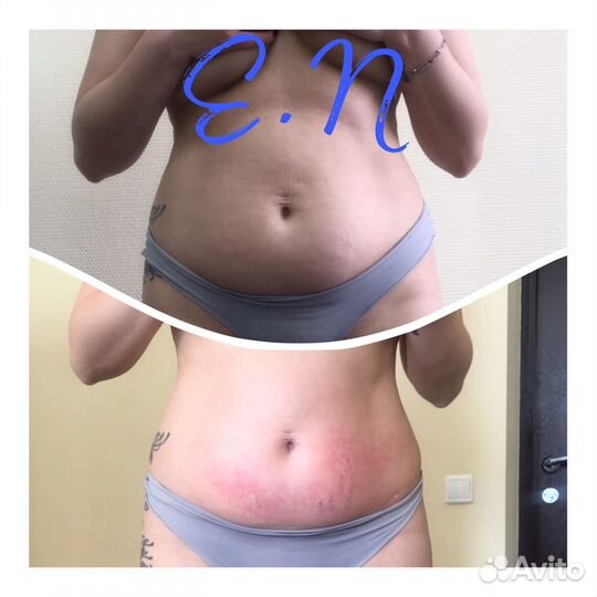 Коррекция фигуры