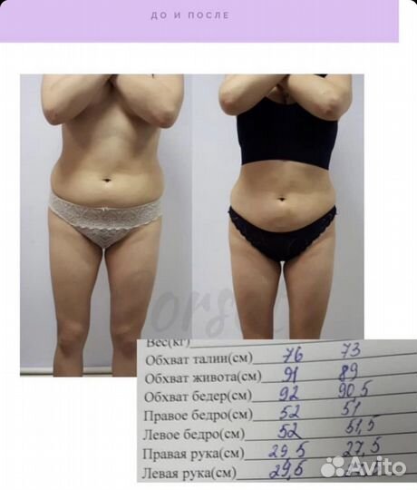 Массаж для похудения