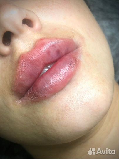 Косметические процедуры