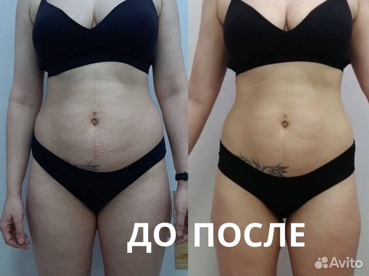 Массаж проблемных зон - 5 см за курс