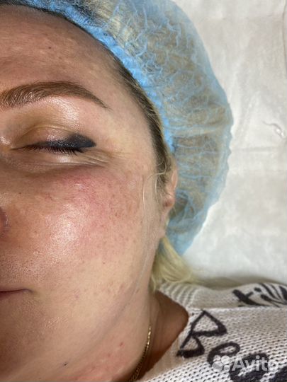 Услуги косметолога