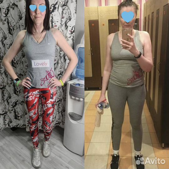 LPG массаж, Vela Shape, Кавитация