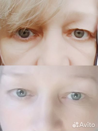 Специалист Витапластики Севастополь