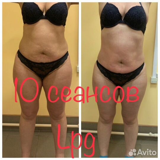 LPG массаж метро Нарвская