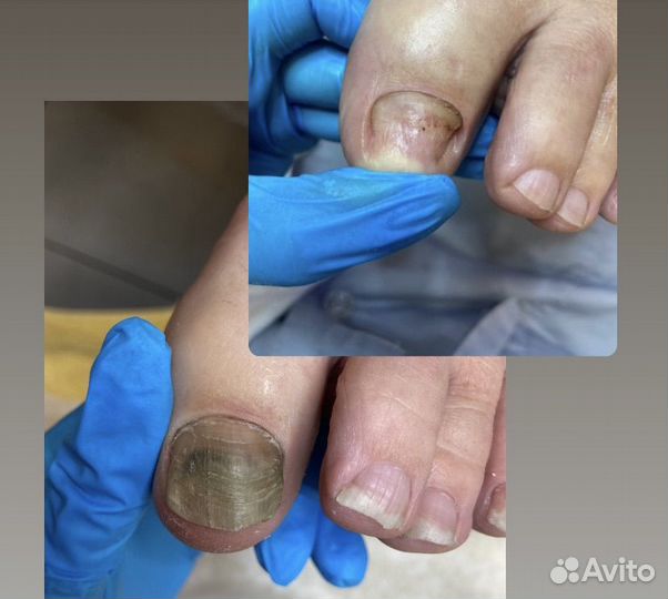 Подолог / медицинский педикюр