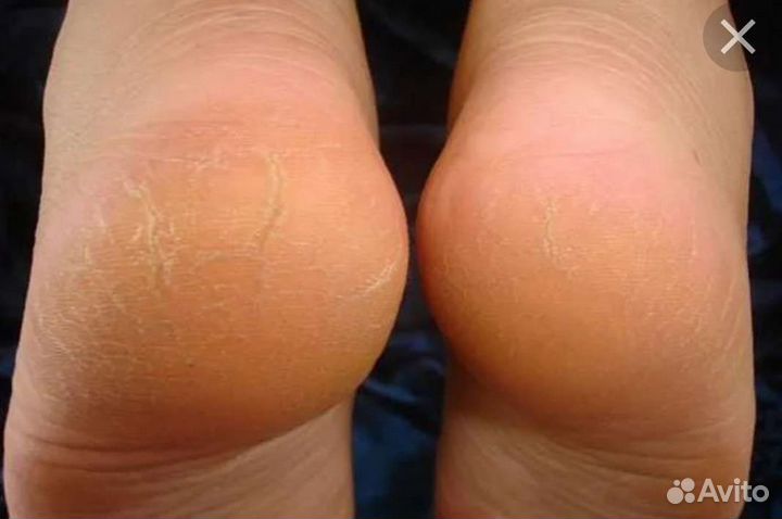 Smart педикюр