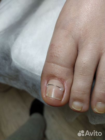 Услуги подолога