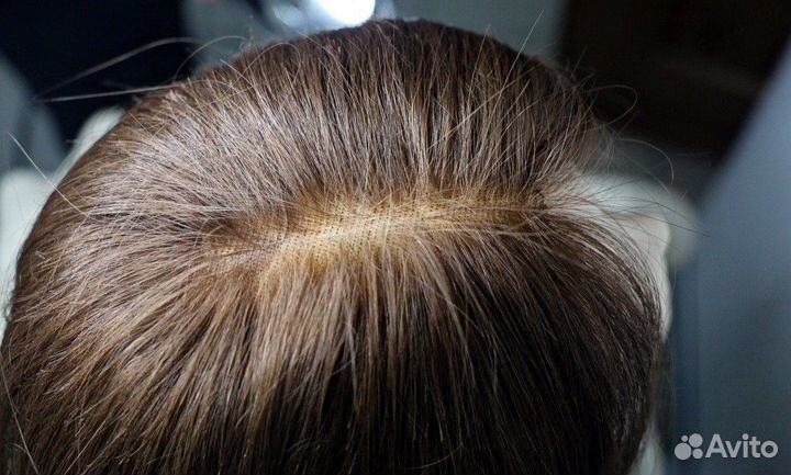 Парики, системы замещения волос, накладки