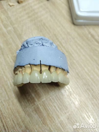 Зубной техник керамист