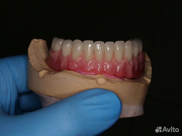 Зубной техник All-on-4