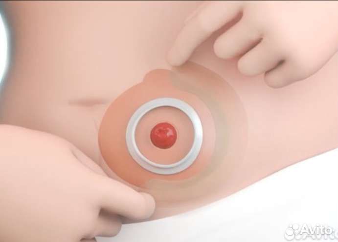 Эластичная пластина -полукольцо