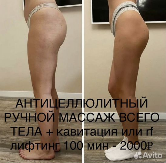 Коррекция фигуры