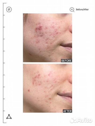 Ночная маска для лица от высыпаний Allies of Skin